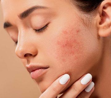 کلخنگ برای لک صورت